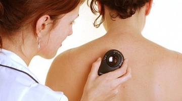 skin-cancer-check skin-cancer-check